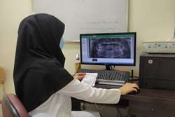 نکاتی در مورد رادیوگرافی پانورامیک (OPG) در دندانپزشکی