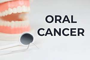 سرطان دهان(oral cancer)  چیست و چه بخش‌هایی را درگیر می‌کند؟