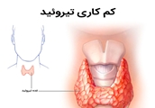 با کم ‌کاری مادرزادی تیروئید بیشتر آشنا شویم!