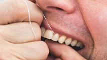 8 گام برای استفاده صحیح از نخ دندان