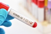 چه آزمایش هایی برای بیماری COVID-19 انجام می شود؟
