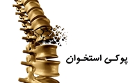 اهمیت دریافت کافی ویتامین D در پیشگیری از پوکی استخوان