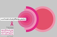 20 گام سلامتی برای پیشگیری از ابتلا به سرطان پستان