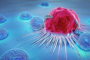سرطان های شایع مردان: معده، پروستات، مثانه