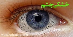 بخش اول آنچه باید در مورد خشکی چشم بدانیم 