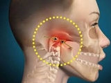 ناهنجاری مفصل گیجگاهی فکی (TMJ)؛ نشانه ها و راه های درمان 
