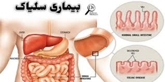 آشنایی با بیماری سلیاک و علایم آن